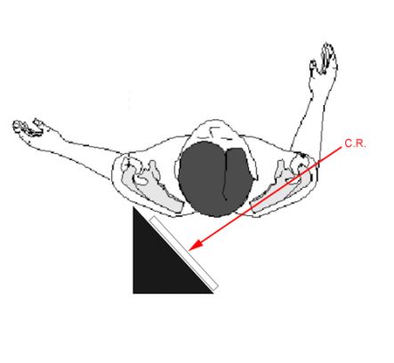 modified lateral scapula view