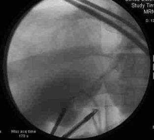 Case of the week - wikiRadiography
