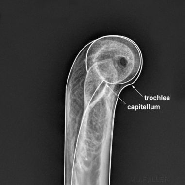 lateral humerus