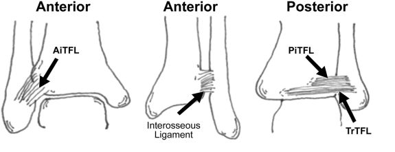 ankle syndesmosis